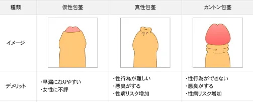 上野クリニックの包茎の種類