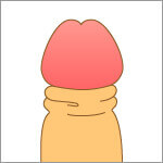 &nbsp;カントン包茎