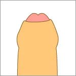名古屋で包茎手術が安いおすすめのクリニック　東京上野クリニックのLP画像　仮性包茎