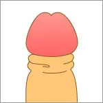 名古屋で包茎手術が安いおすすめのクリニック　東京上野クリニックのLP画像　カントン包茎